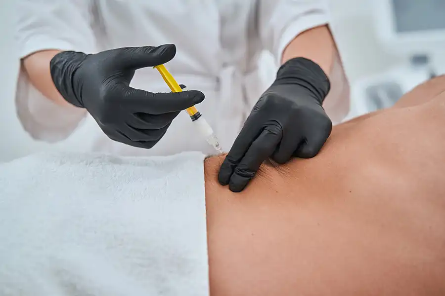 Hyaluronic acid body filler for contouring and volume restoration in Dubai